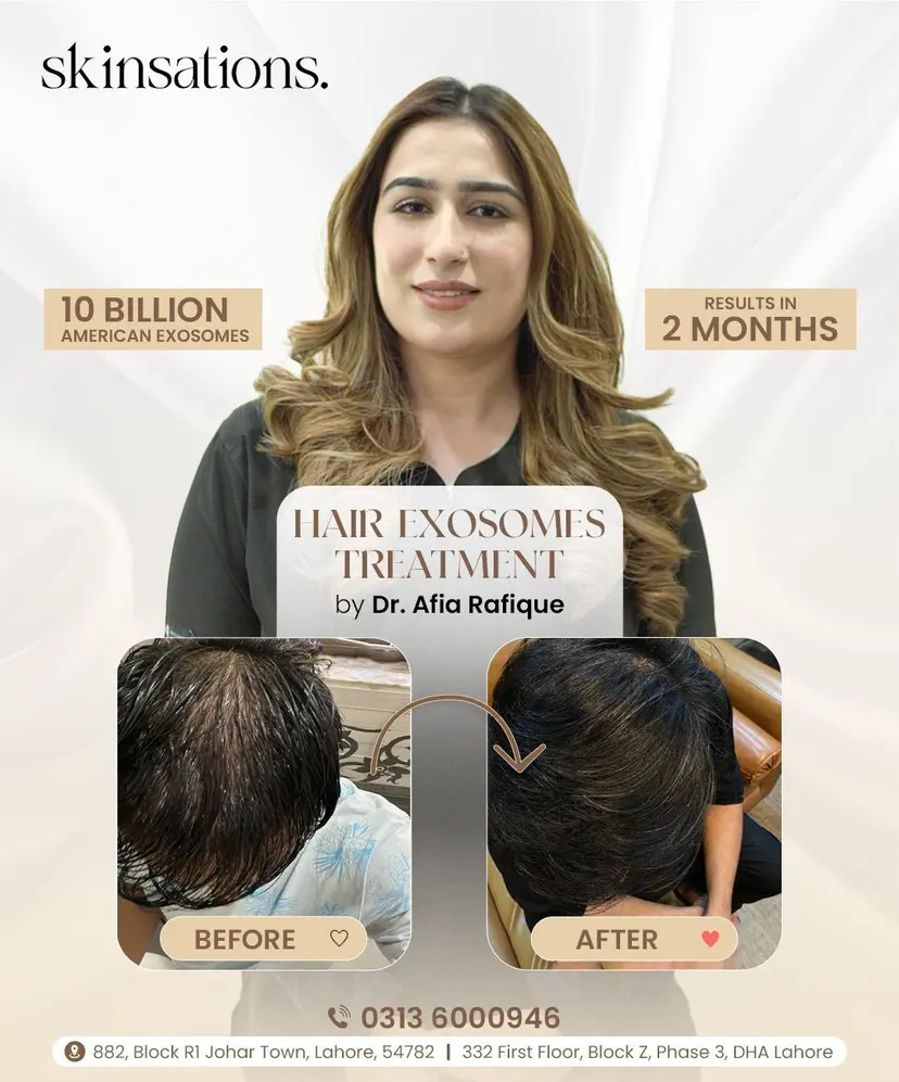 10 Billion American Exosomes Scalp Revitalization — Before and After at Skinsations Lahore